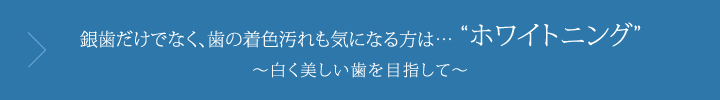 銀歯だけでなく、歯の着色汚れも気になる方は……ホワイトニング白くう美しい歯を目指して……