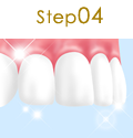 Step05