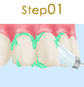 Step01