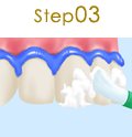 Step01