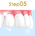 Step01